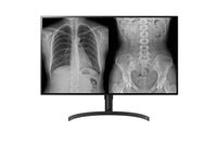 LG 32HL512D-M Computerbildschirm 80 cm (31.5") 3840 x 2160 Pixel Full HD Schwarz